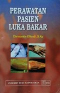 Perawatan Pasien Luka Bakar